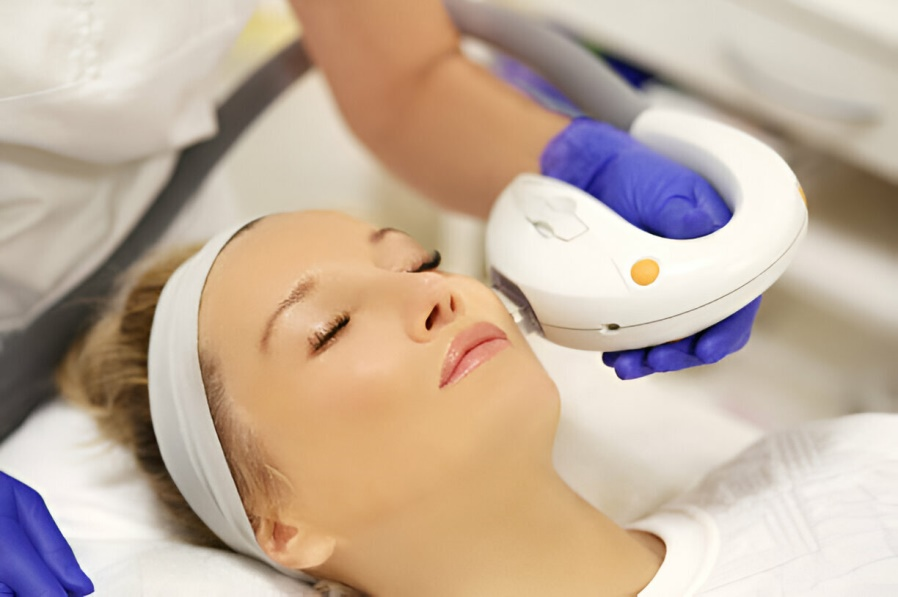 Breaking Down The Factors Affecting The Cool Peel Laser Cost!