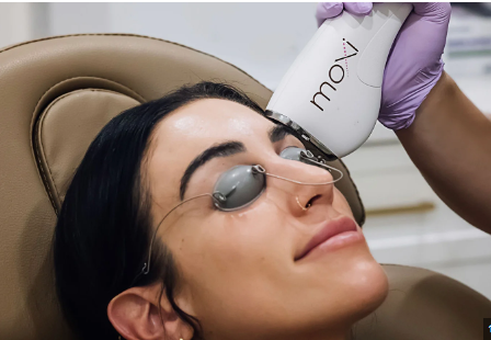 Unveiling a Younger You: Exploring Moxi Laser Treatment in Dubai